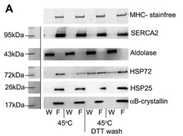 Western blot using Aldolase